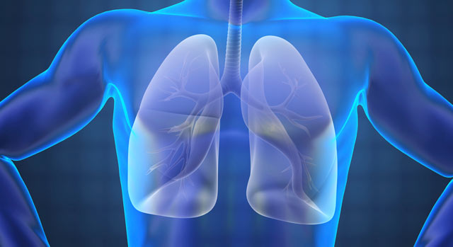 respiratory care desert springs hospital